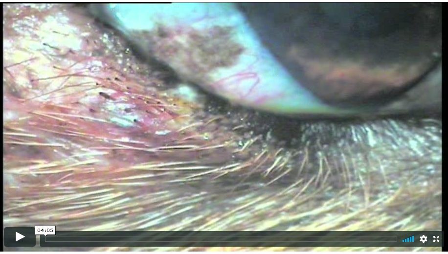Technique d’exérèse de cil ectopique en face interne de la paupière chez un chien par Frank Famose