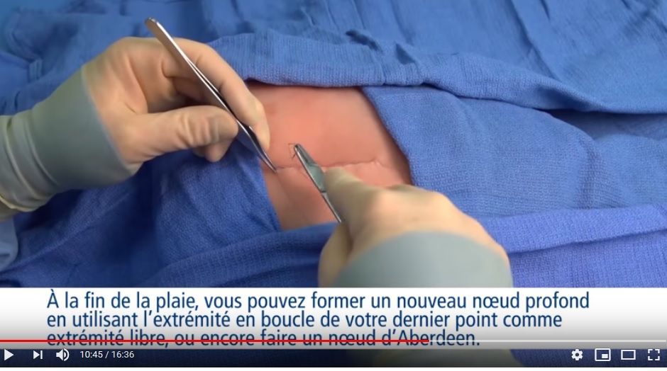 Chirurgie: sutures, du noeud que diable !